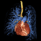 medical illustration of the human heart