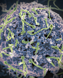 Ebola virus (green) is shown on cell surface