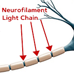 Neurofilament Light Chain on the Neuron
